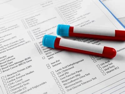 sphi lab result|How to Read Syphilis Test Results: A Complete Guide.